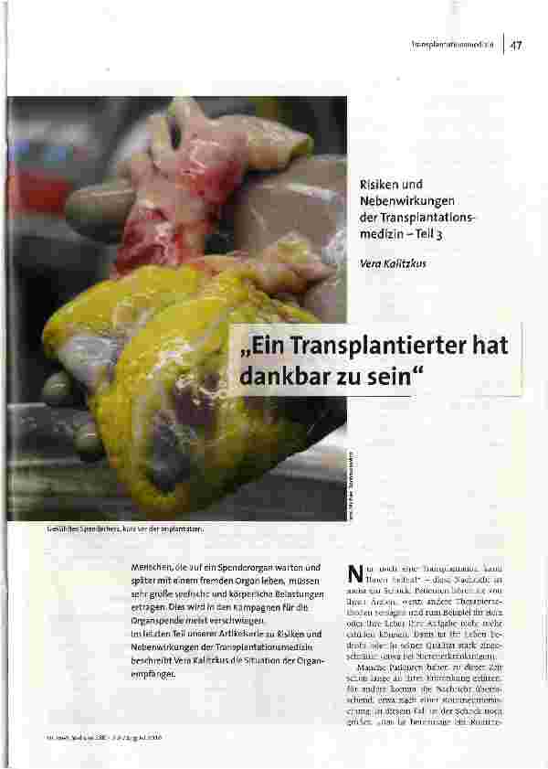 [doc_118730] Ein Transplantierter hat dankbar zu sein Risiken und Nebenwirkungen der Transplantationsmedizin-Teil 3